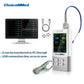 ChoiceMMed Veterinary Monitor Portable Handheld Rechargeable Medical Pulse Oximeter Health Monitors SPO2 PI PR Oximetro For Vet